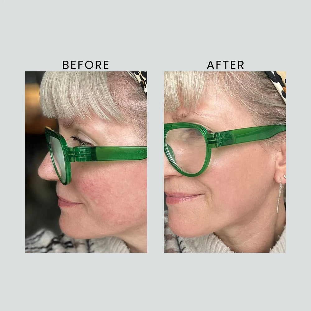 Anti-Redness & Pigmentation SPF50 LIGHT - 30ml